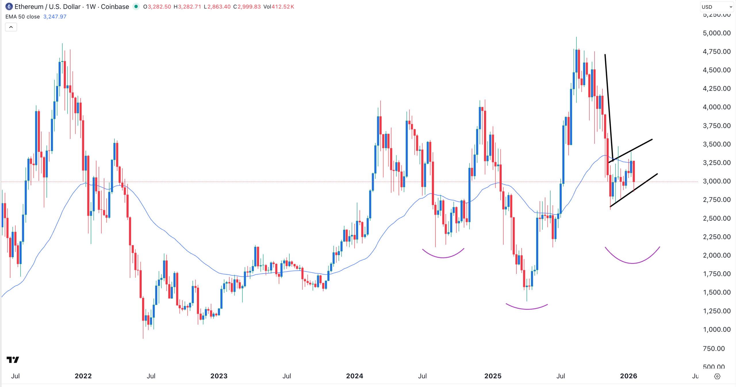 Ethereum price chart | Source: TradingView